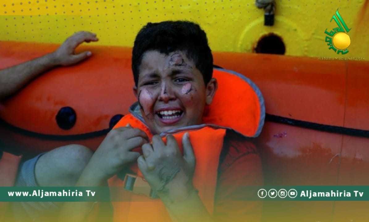 طفل ليبي مصاب بحروق