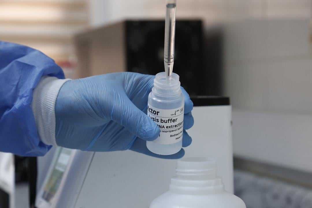 التحديث اليومي للوضع الوبائي المحلي