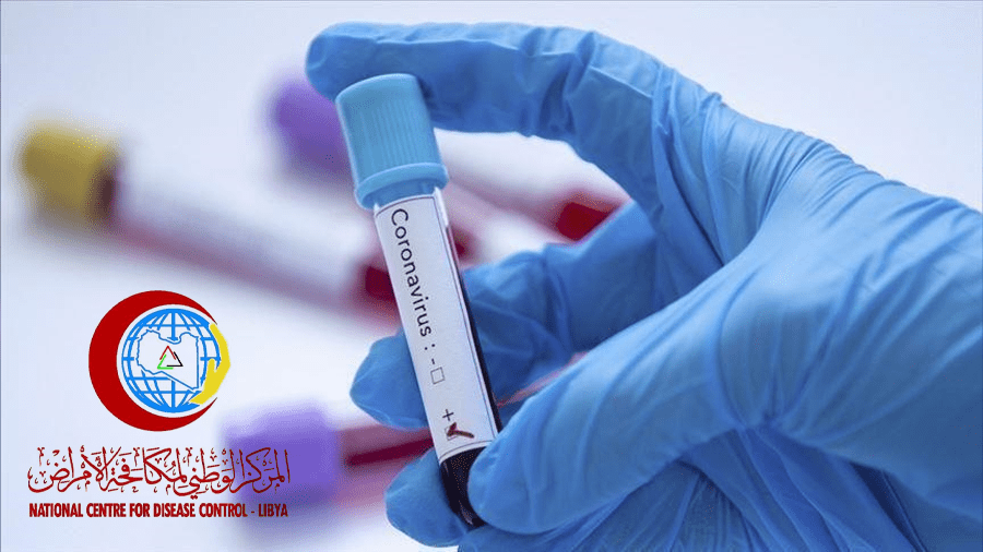 التحديث اليومي