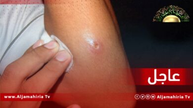 عاجل| ارتفاع عدد المصابين باللشمانيا في بني وليد إلى 675 حالة حتى الآن