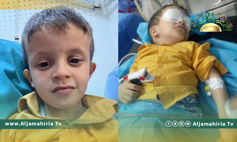 الفريق الطبي بمستشفى العيون يتمكن من إعادة الرؤية لطفل فقد بصره