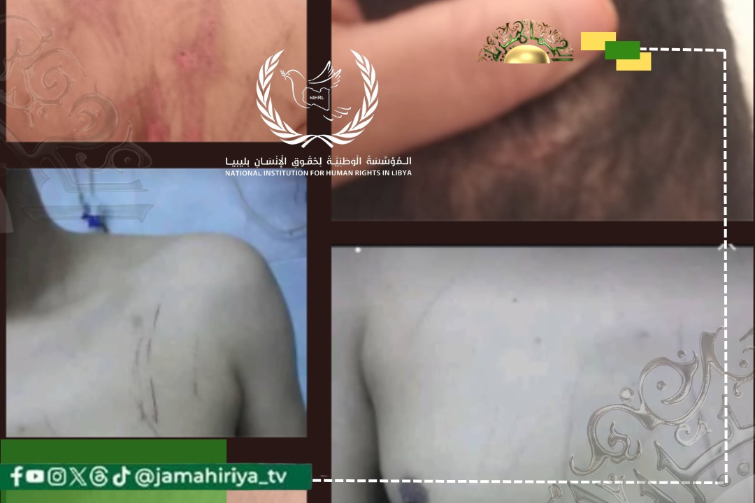 حقوق الانسان تطالب بالتحقيق في اختطاف وتعذيب مواطن بسرت بعد شكوى رسمية