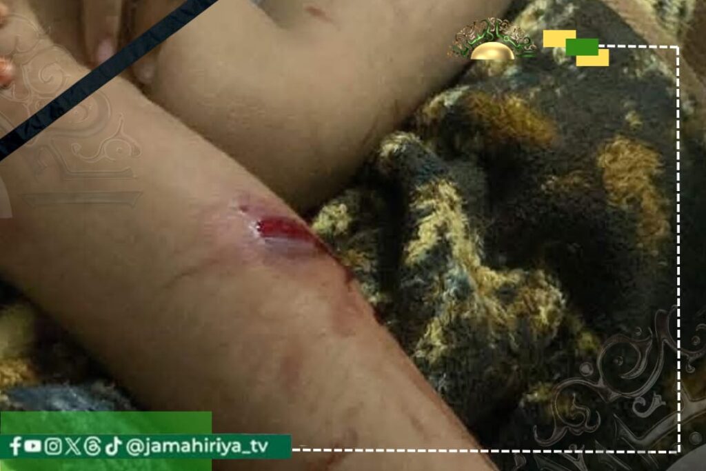 حقوق الإنسان تدين اشتباكات جنزور وتدعو النائب العام لفتح تحقيق