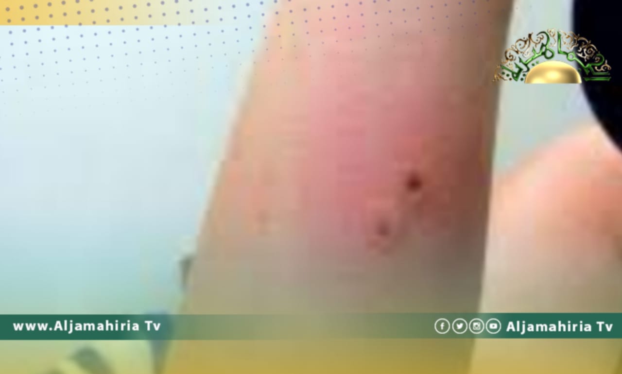 لعدم وجود أطباء في 3 مستشفيات بالجنوب.. طفلة تفارق الحياة.. وهذه التفاصيل